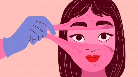acne skincare routine